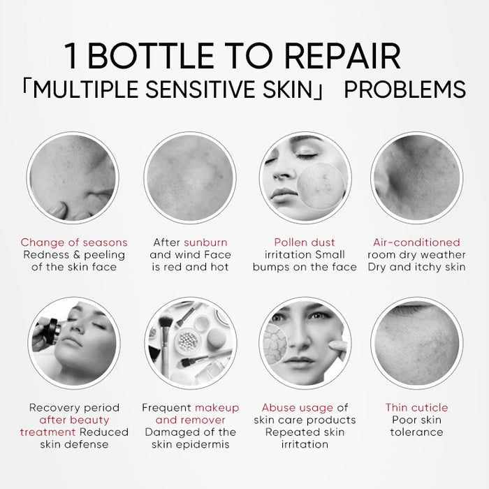 WINONA Sensitiveness Relieving Moisturizing Tolerance-Extreme Cream