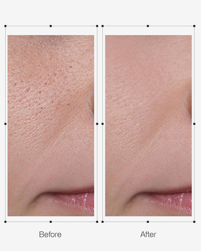 OGANACELL DERX Cleanser 120mL