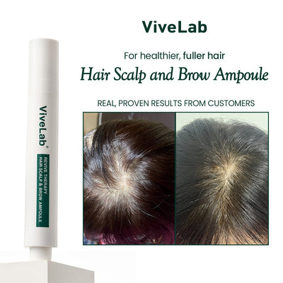 Vivelab Scalp & Hair Serum for Thinning Hair (15ml) – Clinically Tested, Nourishing Formula with Biotin & Peptides for a Healthy Scalp & Fuller-Looking Hair