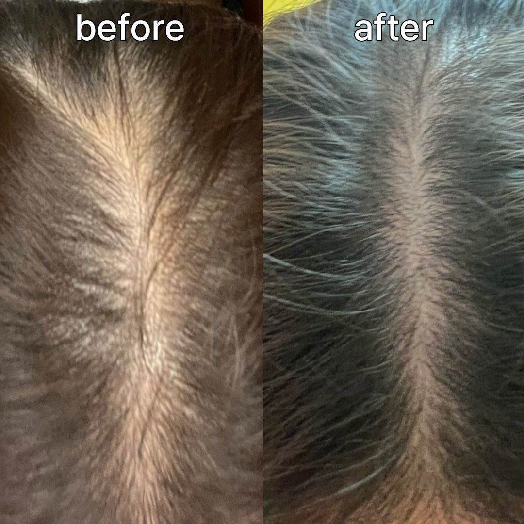 Vivelab Scalp & Hair Serum for Thinning Hair (15ml) – Clinically Tested, Nourishing Formula with Biotin & Peptides for a Healthy Scalp & Fuller-Looking Hair
