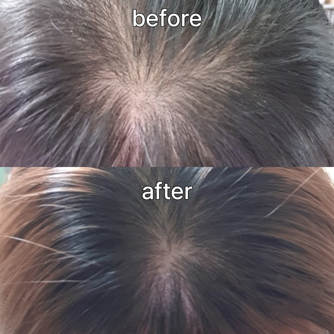 Vivelab Scalp & Hair Serum for Thinning Hair (15ml) – Clinically Tested, Nourishing Formula with Biotin & Peptides for a Healthy Scalp & Fuller-Looking Hair