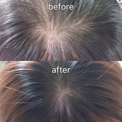 Vivelab Scalp & Hair Serum for Thinning Hair (15ml) – Clinically Tested, Nourishing Formula with Biotin & Peptides for a Healthy Scalp & Fuller-Looking Hair