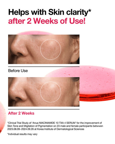 Anua Niacinamide 10% + TXA 4% Dark Spot Correcting Serum Set 30ml
